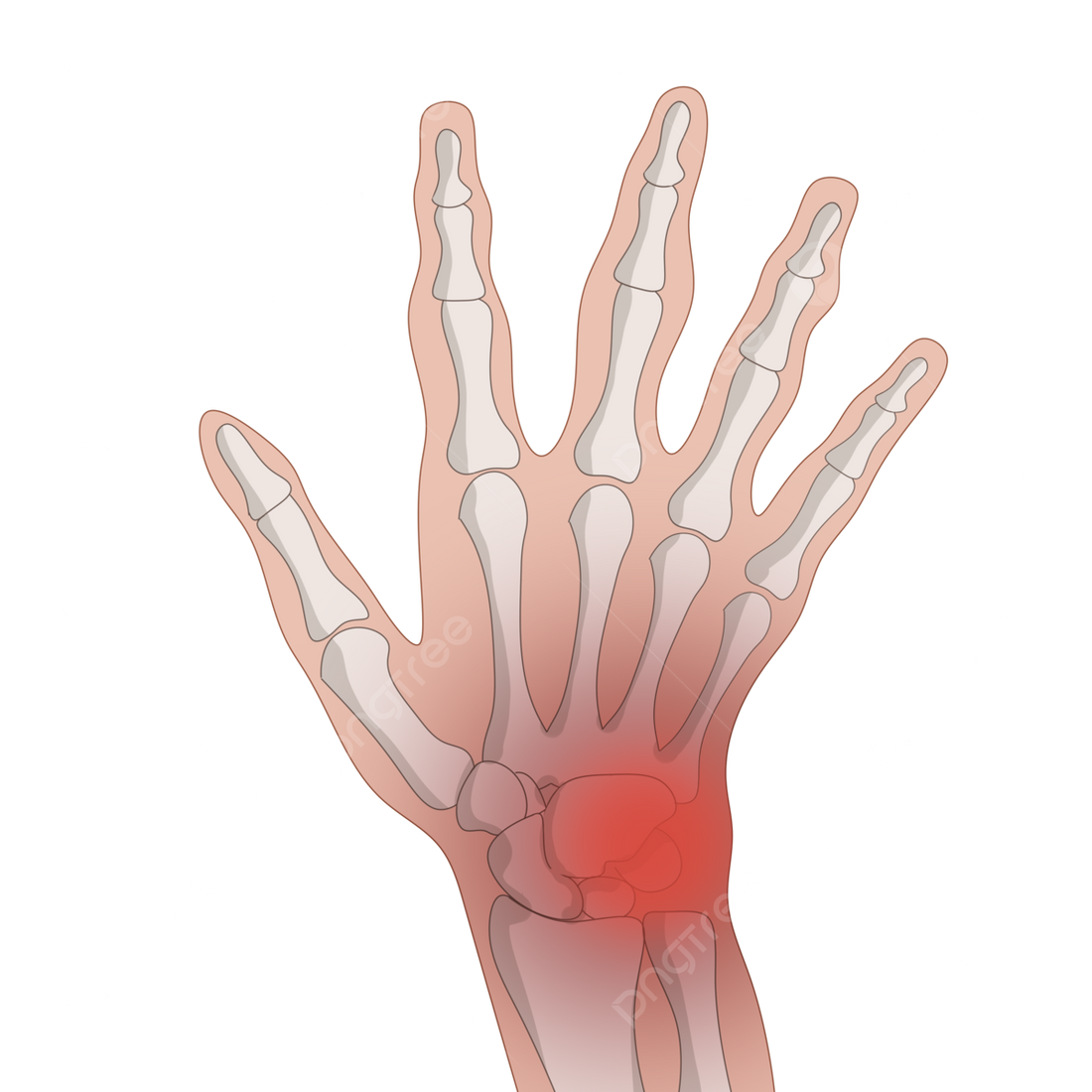 Japan’s $3,800 Arthritis Secret:  Why They Pay Less — But Get More Relief